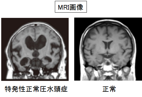 脳神経外科 主な対象疾患の説明 6 部門紹介 豊橋市民病院